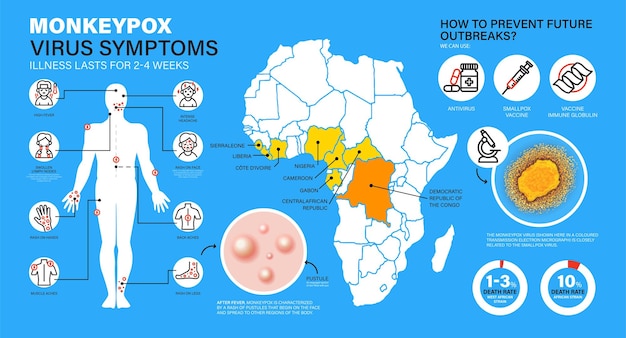 Infografika Monkeypox Wirus Małpy Objawy