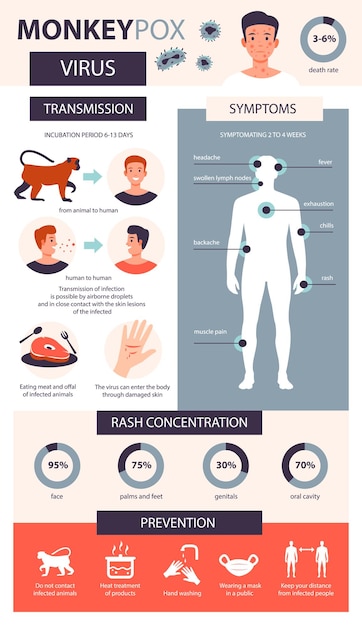 Infografika Ospy Małp Objawy Zakażenia Zapobieganie Chorobie Małpiej Ospy