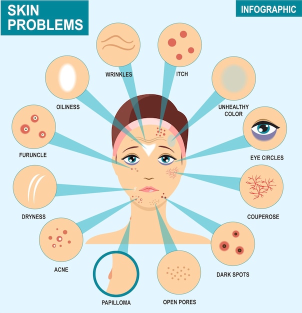 Infografika Problemów Skórnych Kobieta I Zestaw Najczęstszych Problemów Skórnych Powinny Zadbać O Trądzik