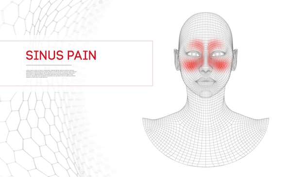 Kobieta Z Bólem Zatok Nosowych. Zakażenie Nosa, Ból Zatoki Czołowej, Anatomia Nosa. Kobieta Ludzka Twarz. Wektor Ilustracja Koncepcja Medyczna.