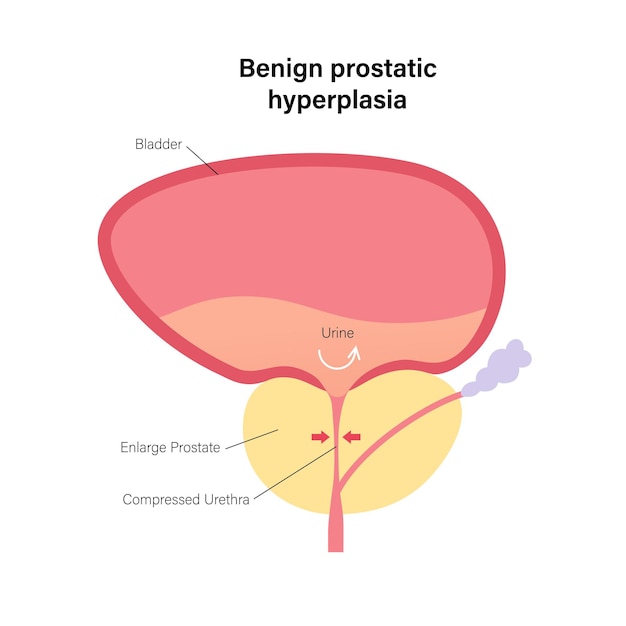 Koncepcja Informacji Bph