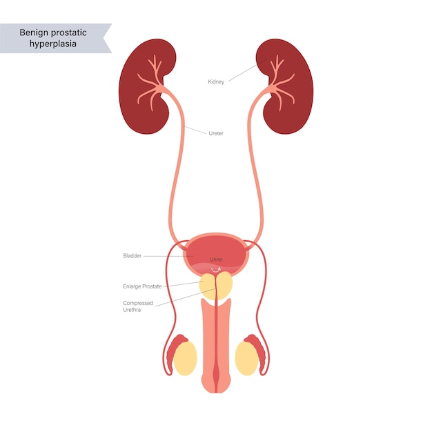 Koncepcja Informacji Bph