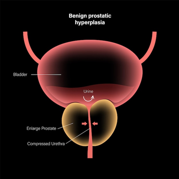 Koncepcja Informacji Bph