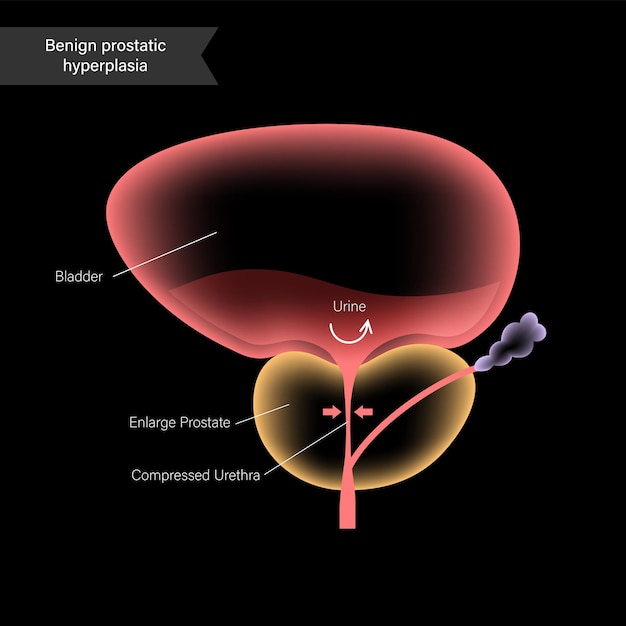 Koncepcja Informacji Bph