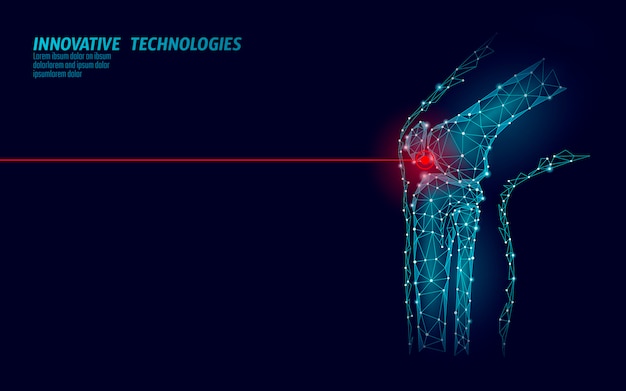 Ludzka Kolana Złącza 3d Modela Wektoru Ilustracja. Przyszłościowa Technologia Low Poly Leczy Leczenie Bólu.