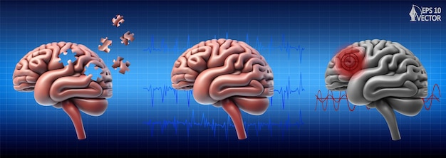 Plik wektorowy ludzki mózg model anatomiczny realistyczny zestaw ilustracji wektorowych dla stron internetowych z aplikacjami medycznymi