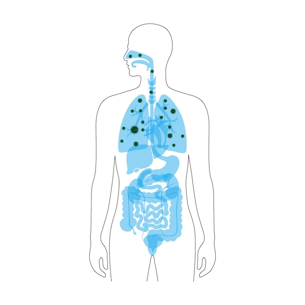 Plik wektorowy ludzkie płuca z infekcją wirusową koncepcja choroby i epidemii koronawirusa