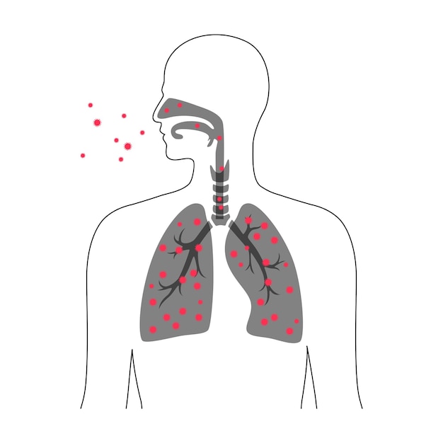 Plik wektorowy ludzkie płuca z infekcją wirusową koncepcja choroby i epidemii koronawirusa