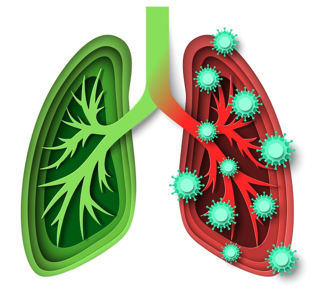 Plik wektorowy ludzkie płuca zdrowe i zakażone wirusem, ilustracji wektorowych w stylu sztuki papieru. zakażenie koronawirusem, zapalenie płuc, zakażenie układu oddechowego, nowotwór. opieka zdrowotna płuc. pulmonologia.