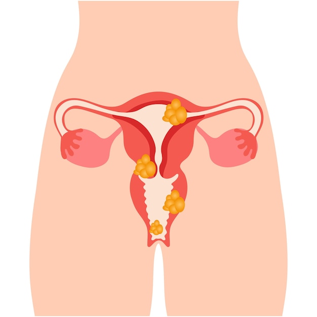 Plik wektorowy medyczny obraz żeńskiego układu rozrodczego w ilustracji wektorowych
