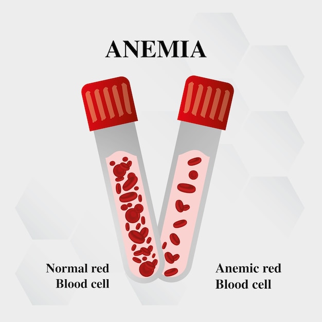 Plik wektorowy niedokrwistość czerwona krew światowy dzień hemofilii z komórek żelaza