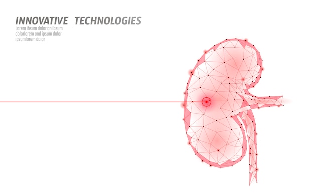 Operacja Laserowa Nerki Ludzkiej Low Poly. Medycyna Choroba Leczenie Odwykowe Bolesny Obszar. Czerwone Trójkąty Wielokątne Renderowania 3d. Apteka Dryluje Raka Odzysku Szablonu Ilustrację