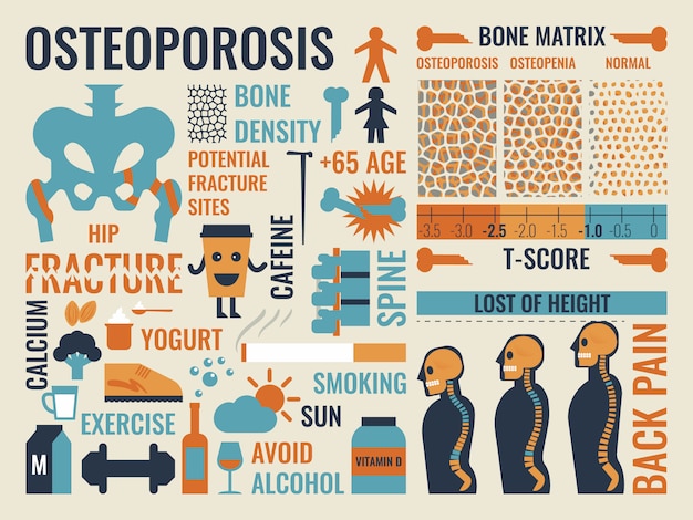 Osteoporoza