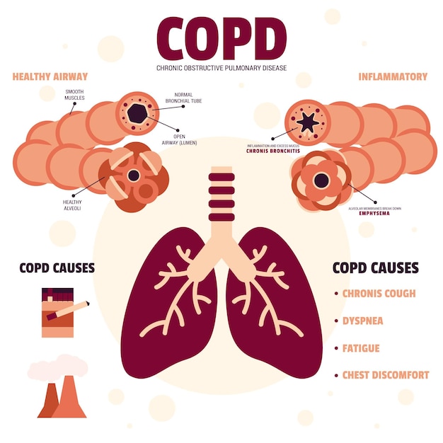 Plik wektorowy płaska konstrukcja infografiki copd