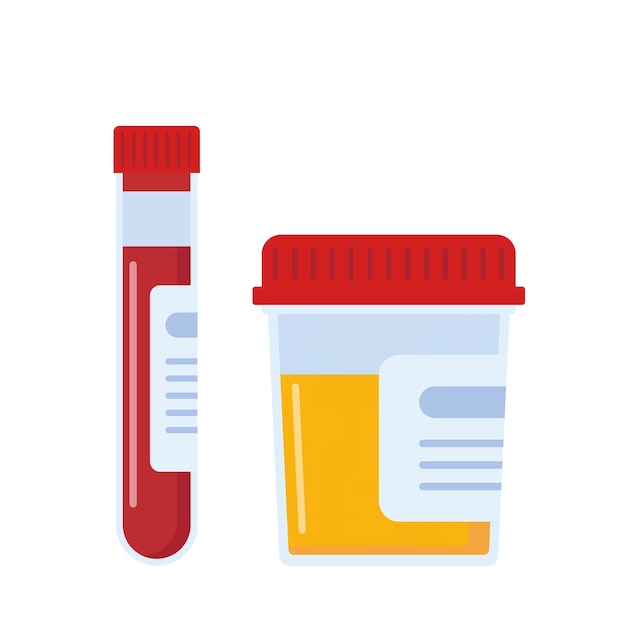Plik wektorowy próbki laboratoryjne moczu i krwi próbka medyczna w szklanej probówce