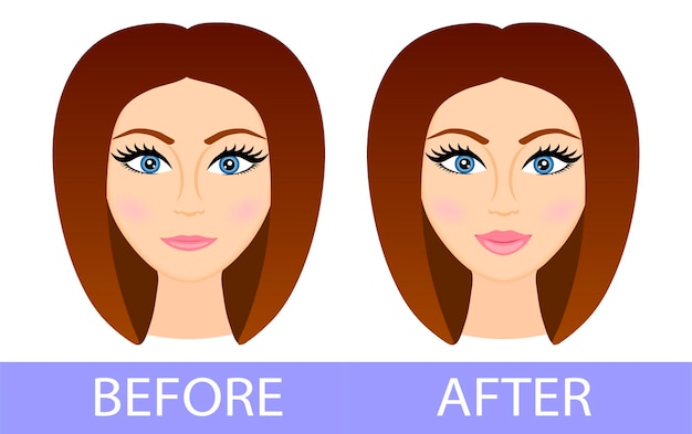 Plik wektorowy przed i po korekcji ust powiększanie ust przed i po wypełnieniu ust chirurgia plastyczna