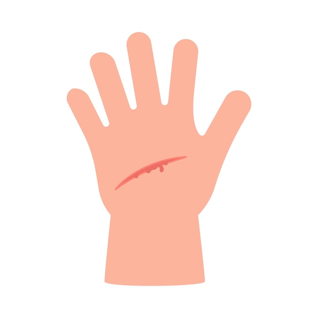 Plik wektorowy rana dłoni dziecka zadrapanie skóry cięcie urazu skóry krwawienie cięcie ilustracja wektora