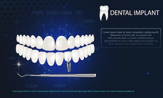 Realistyczny Biały Implant Dentystyczny Na Niebieskim Tle Wektorowy Model 3d Zęba Z Nitką