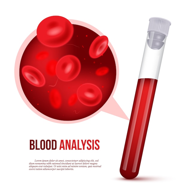 Plik wektorowy realistyczny projekt plakatu reklamowego analizy krwi z wypełnioną probówką krwią i komórką w czerwonym ludzkim płynie przy wielokrotnym powiększaniu.