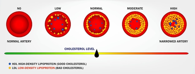 Plik wektorowy realistyczny rodzaj cholesterolu w izolowanej tętnicy. wektor eps