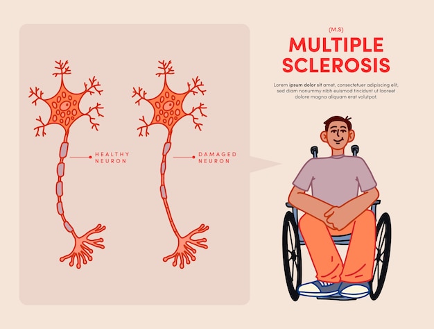 Plik wektorowy ręcznie rysowane ilustracja stwardnienia rozsianego