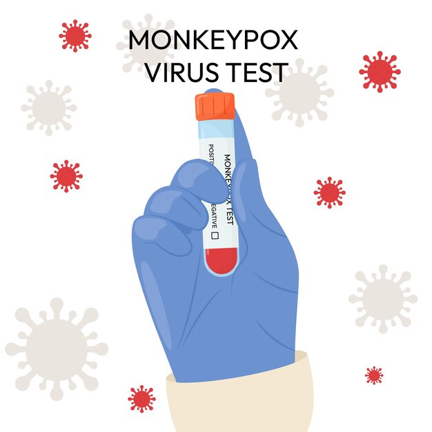 Ręka lekarza w rękawicy ochronnej trzyma probówkę Test na wirusa ospy małp Systemy testowe