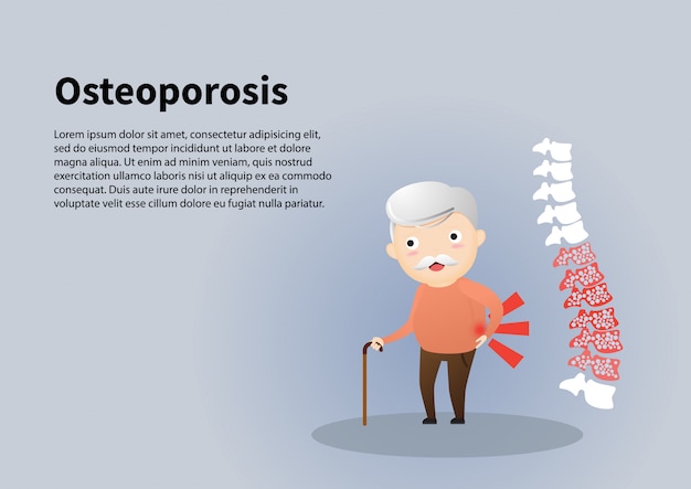 Stary Człowiek Z Ilustracją Osteoporozy.