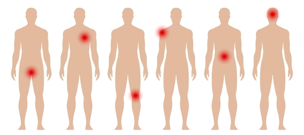 Plik wektorowy sylwetka człowieka z czerwonymi kropkami w różnych częściach ciała bóle i bóle ilustracji wektorowych medycznych