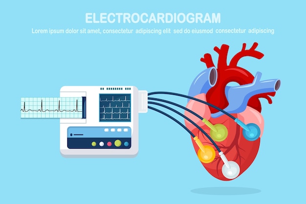 Urządzenie Ekg Na Białym Tle. Monitor Elektrokardiogramu Do Diagnostyki Ludzkiego Serca Z Wykresem Ekg. Sprzęt Medyczny Dla Szpitala Z Wykresem Rytmu Bicia Serca. Płaska Konstrukcja