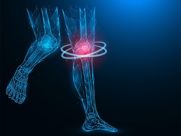 Plik wektorowy wielokątna ilustracja wektorowa ludzkich nóg bolesnych i zaognionych w kolanie koncepcja odzyskiwania chorego kolana