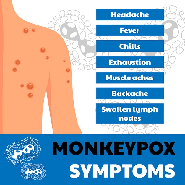 Plik wektorowy wirus małpiej ospy objawy baner internetowy dotyczący zakażenia skóry osoby ospy małpiej wykorzystywany do świadomości ludzi