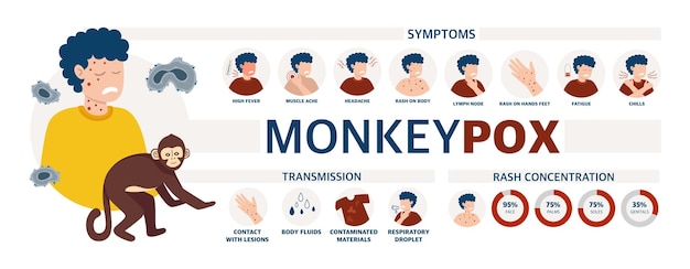 Wirus małpiej ospy Plakat informujący o pandemii i rozprzestrzenianiu się choroby Obrazy człowieka