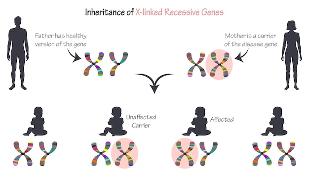 Wykres Infografiki Dziedziczenia Recesywnych Genów Sprzężonych Z Chromosomem X