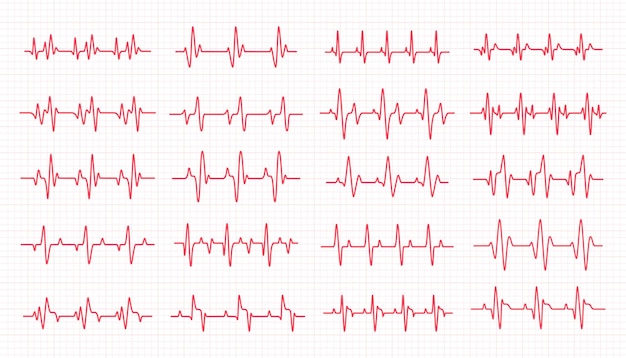 Wykres Rytmu Serca Sprawdzanie Bicia Serca W Celu Postawienia Diagnozy