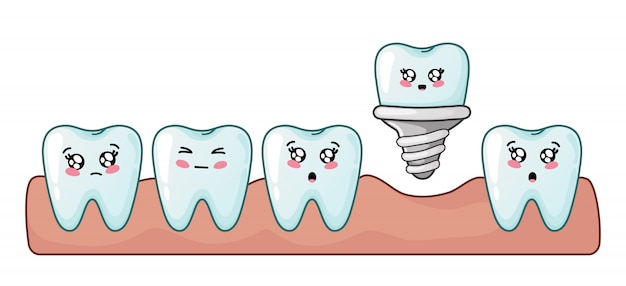 Ząb Kawaii Kreskówki Implantu Stomatologicznego ładny Charakter Opieki Stomatologicznej