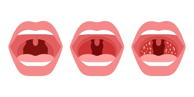 Plik wektorowy zastosowany gradient symbolu ucha, nosa i gardła i efekty przejrzystości