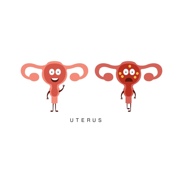 Plik wektorowy zdrowa vs niezdrowa ilustracja infografiki macicy