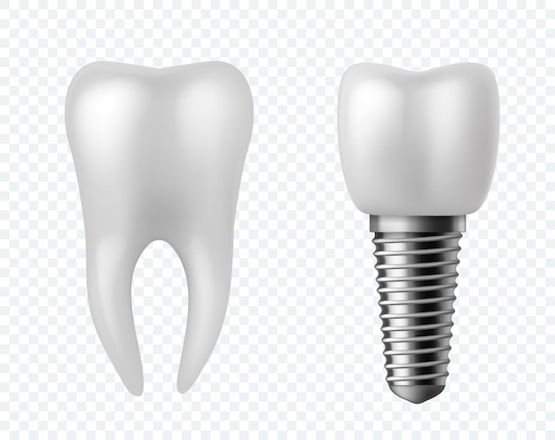 Zęby i implant. Chirurgia stomatologiczna plakat ludzki biały szkliwo ząb korona proteza technologia ortodontyczna. Sztucznych zębów implantacja szczęki wektor realistycznej kliniki stomatologii na białym tle koncepcja