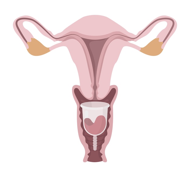 Żeński Układ Rozrodczy Z Miseczką Menstruacyjną W środku