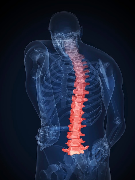 3D renderowana medyczna ilustracja męskiej anatomii ból pleców zwykłe czarne tło widok tylny