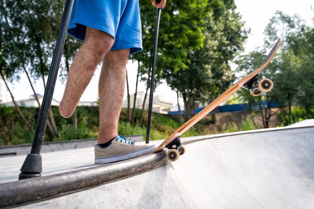 Amputowana łyżwiarka Spędzająca Czas W Skateparku. Pojęcie O Niepełnosprawności I Sporcie