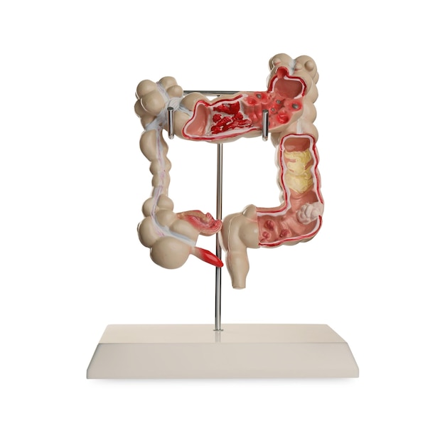 Anatomiczny model jelita grubego na białym tle Gastroenterologia