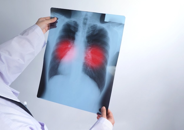 Azjatycka lekarka w średnim wieku stojąca i trzymająca film rentgenowski lub radiografię, na którą patrzy