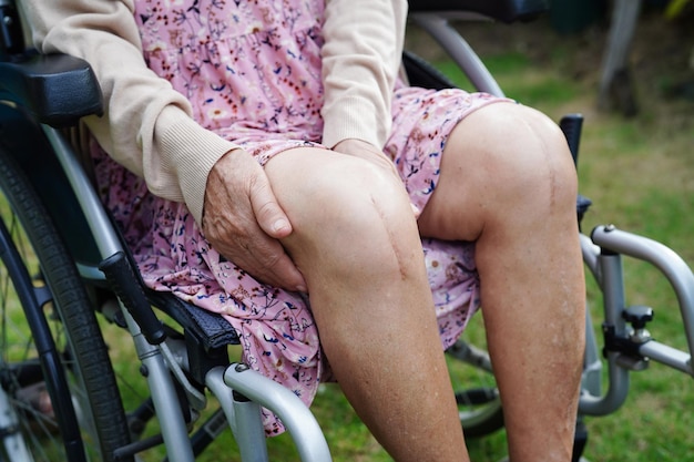 Azjatycka starsza kobieta po operacji wymiany stawu kolanowego w szpitalu