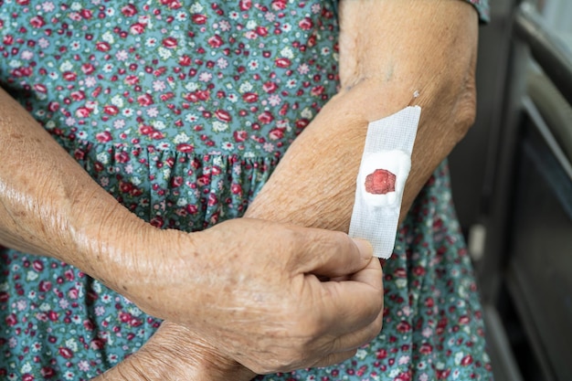 Azjatycka starsza lub starsza starsza kobieta pacjentka pokazuje watę zatrzymaj krwawienie po badaniu pobierania krwi w celu corocznej kontroli stanu zdrowia fizycznego w celu sprawdzenia ciśnienia krwi i poziomu cukru we krwi
