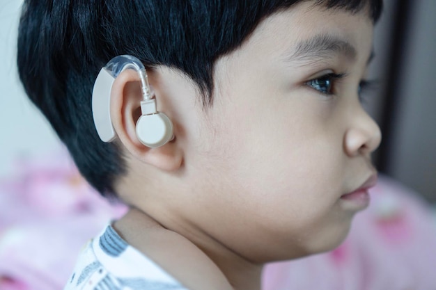 Azjatyckie dziecko ma aparaty słuchowe z problemami ze słuchem Utrata słuchu w dzieciństwie