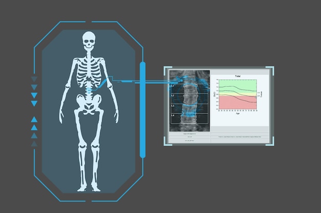 Zdjęcie bada technologiczną cyfrową płytę holograficzną przedstawiającą wyniki gęstości ciała pacjenta koncepcja medycyny futurystycznej koncepcja technologii medycznej