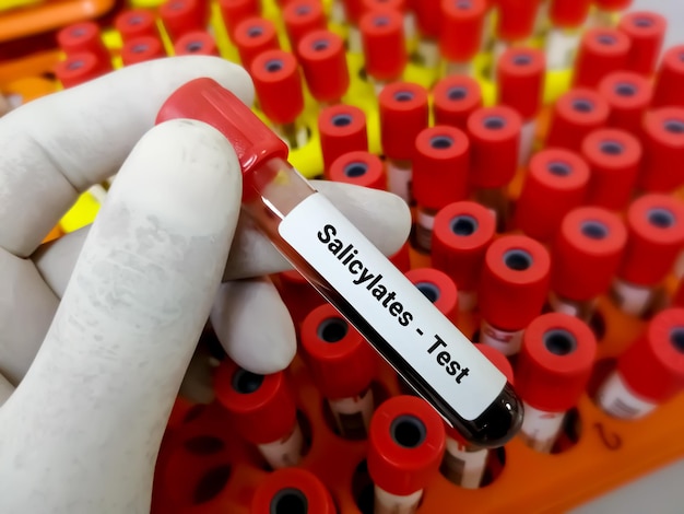 Biochemik lub naukowiec przechowuje próbkę krwi do testu aspiryny lub salicylanu w laboratorium