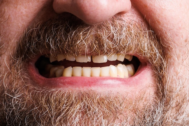 Bliska obraz niedoskonałych męskich uśmiechniętych zębów