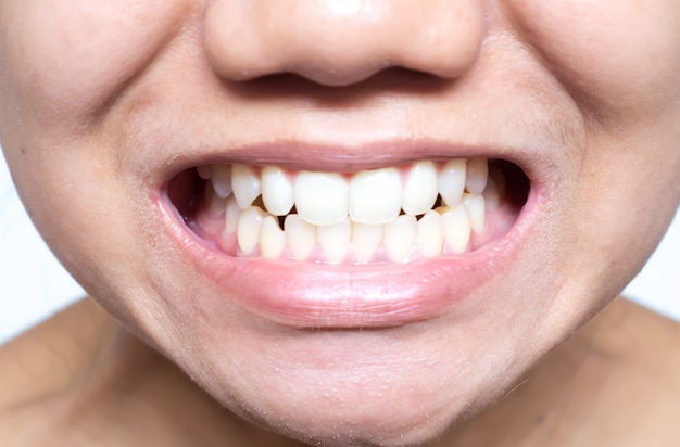 bliska zdjęcie zębów i ust